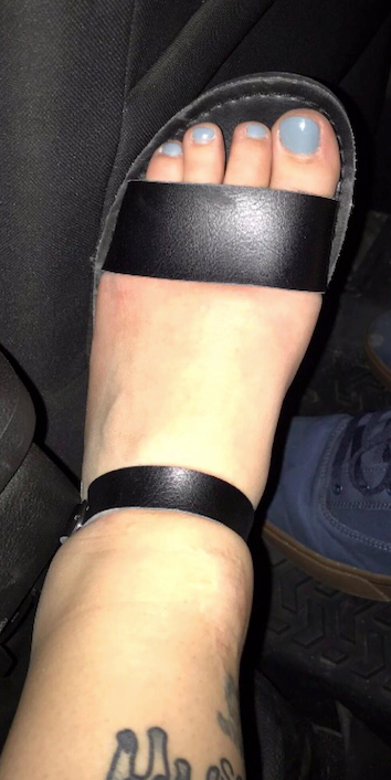 After daily compression