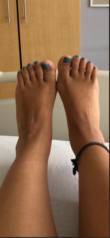 After wearing MamaRelief compression socks