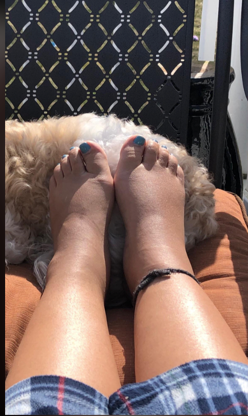 Before wearing MamaRelief compression socks